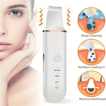 Skinova™- Espátula Facial Ultrasónica