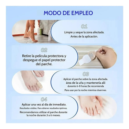 NailPatch™ - Parches Hongos Uñas Pies 21 Unidades